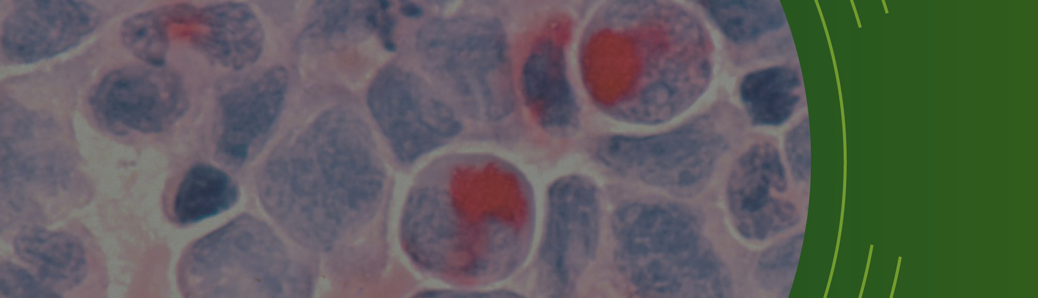 Second Image