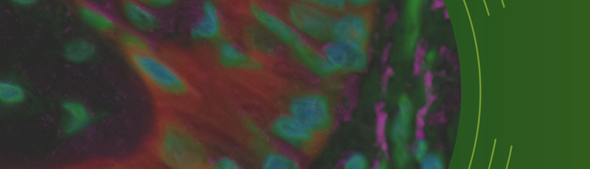 Second Image