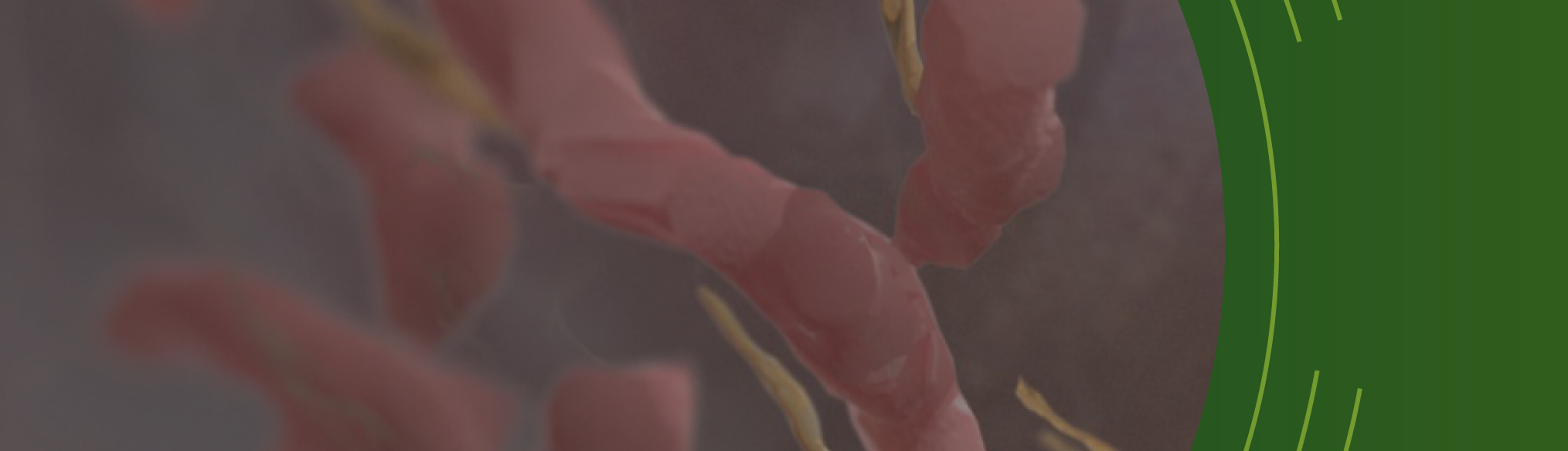Second Image