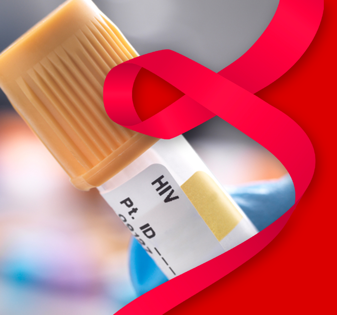 U and Your Baby - HIV and Pregnancy